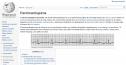 Electrocardiograma | Recurso educativo 26854